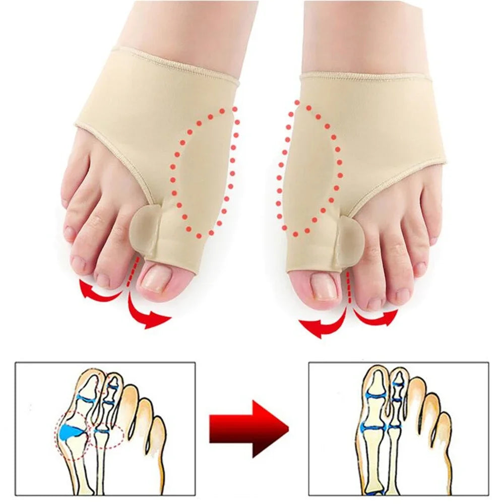 1Pair Hallux Valgus Bunion Corrector Foot Pain Reliefer.